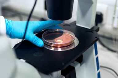 Microscope analysis at Mbi Lafia Medical laboratory